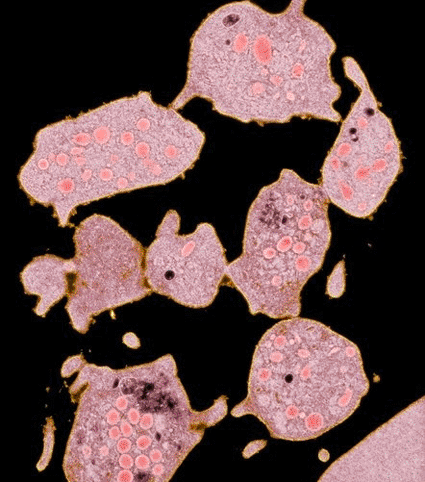 Imagen: Microfotografía electrónica de transmisión a color (TEM) de un corte a través de plaquetas sanguíneas cuya función es el mantenimiento de la hemostasia, la cual se logra principalmente a través de la formación de coágulos sanguíneos (Fotografía cortesía del DR. Gopal Murti / SPL).